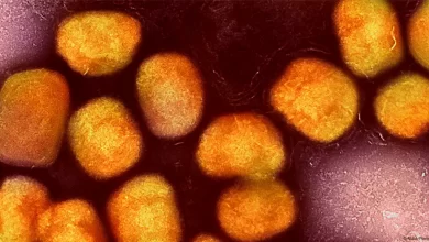 Photo of Não há relação entre mpox e vacina contra covid-19
