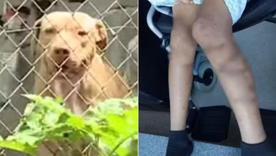 Photo of Cadela é morta e menino de 12 anos hospitalizado após ataque de pit bulls